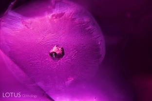 This Mozambique ruby has been heat treated, causing an included crystal to melt. The resulting glass occupies less space than the previous crystal, resulting in a frozen gas bubble.