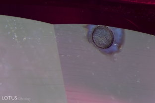 This spall mark, an irregularity on the surface of the ruby, was a result of heat treatment.