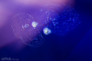Melted crystals with a frosted surface, surrounded by heat-altered fingerprints in a heat-treated sapphire from Sri Lanka. Note the hexagonal symmetry of the fingerprint, which shows that it lies in the basal plane.