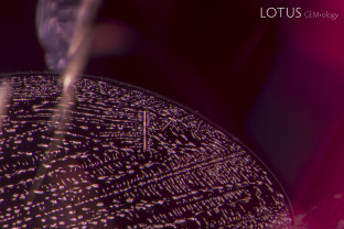 A fingerprint inclusion in a natural spinel from Vietnam, Luc Yen mines. The individual channels of a fingerprint are actually tiny negative crystals.