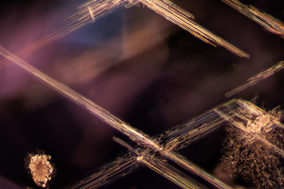 Stellate dislocations (the star-like- needles) radiating from small crystals are a typical feature seen in Vietnamese spinel. By using micro Raman we were able to analyze the center crystals and identify them as zircon.
