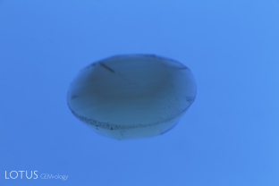 When a yellow sapphire is immersed in a yellow liquid like methylene iodide, it is difficult to see the growth zoning. Placement of a blue filter under the immersion cell provides the necessary contrast to easily spot features such as the curved color banding seen here, which proves this stone to be a Verneuil synthetic.